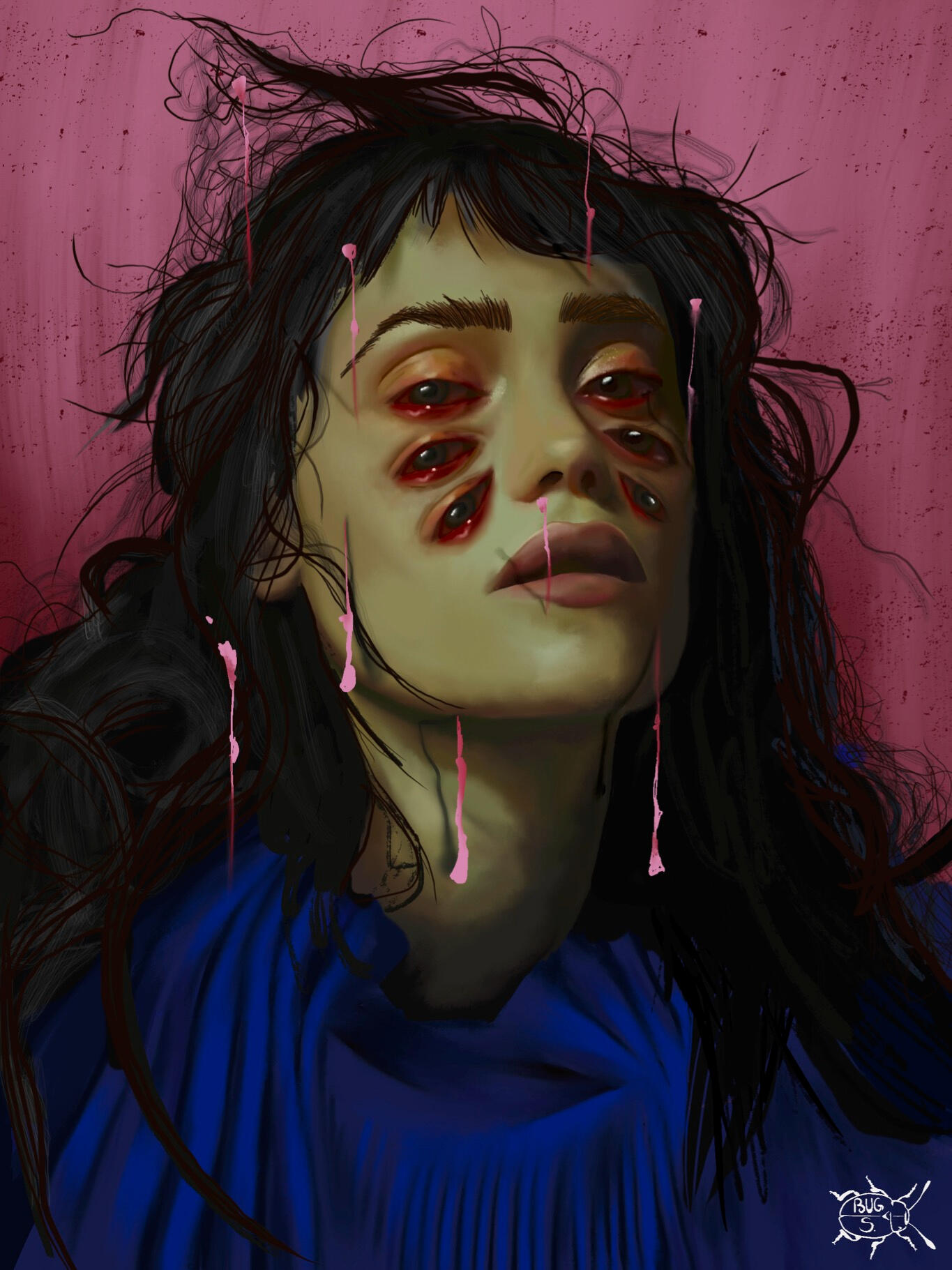 Headache