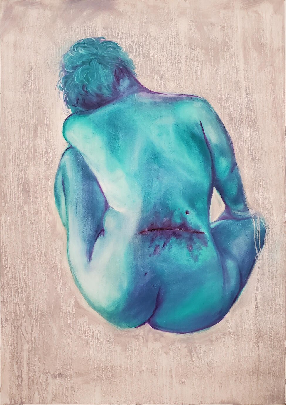 Self Portrait (Beautiful Damage)